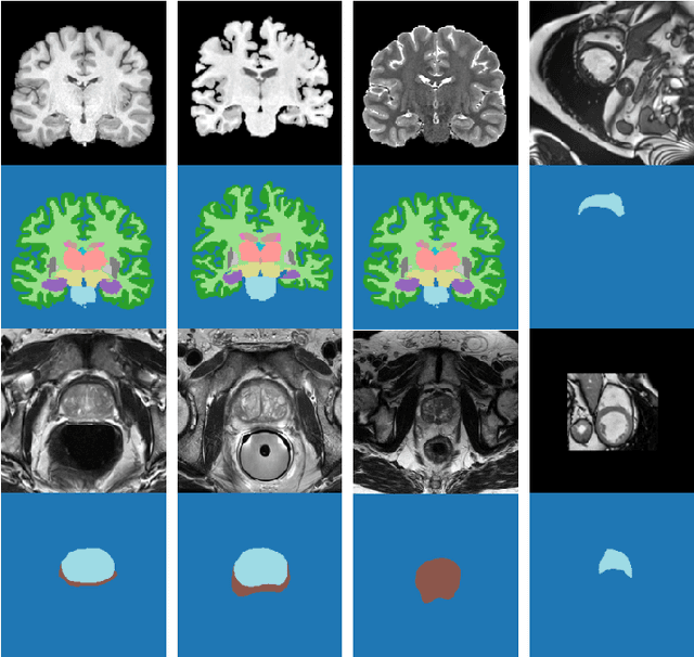 Figure 2 for Test-Time Adaptable Neural Networks for Robust Medical Image Segmentation