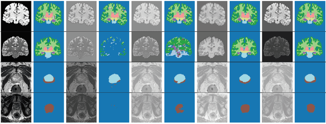 Figure 3 for Test-Time Adaptable Neural Networks for Robust Medical Image Segmentation