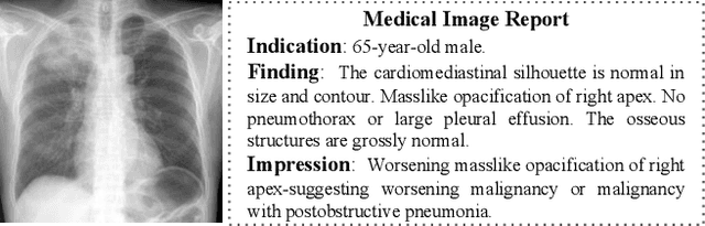 Figure 1 for Knowledge-driven Encode, Retrieve, Paraphrase for Medical Image Report Generation