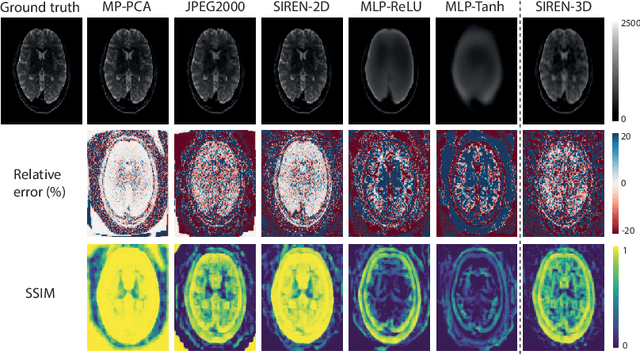 Figure 4 for Lossy compression of multidimensional medical images using sinusoidal activation networks: an evaluation study