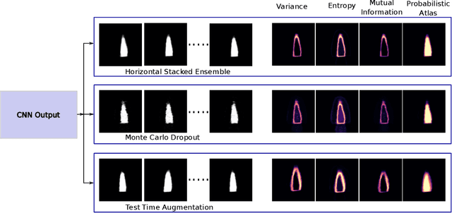 Figure 1 for Uncertainty Estimation in Deep 2D Echocardiography Segmentation