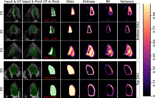 Figure 4 for Uncertainty Estimation in Deep 2D Echocardiography Segmentation