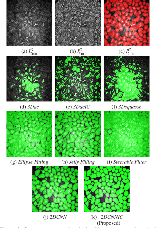 Figure 4 for Tubule segmentation of fluorescence microscopy images based on convolutional neural networks with inhomogeneity correction