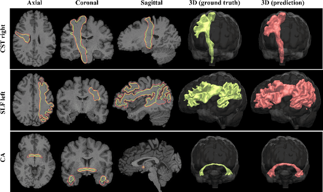 Figure 3 for Direct White Matter Bundle Segmentation using Stacked U-Nets