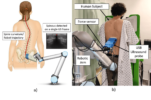 Figure 2 for Follow the Curve: Robotic-Ultrasound Navigation with Learning Based Localization of Spinous Processes for Scoliosis Assessment