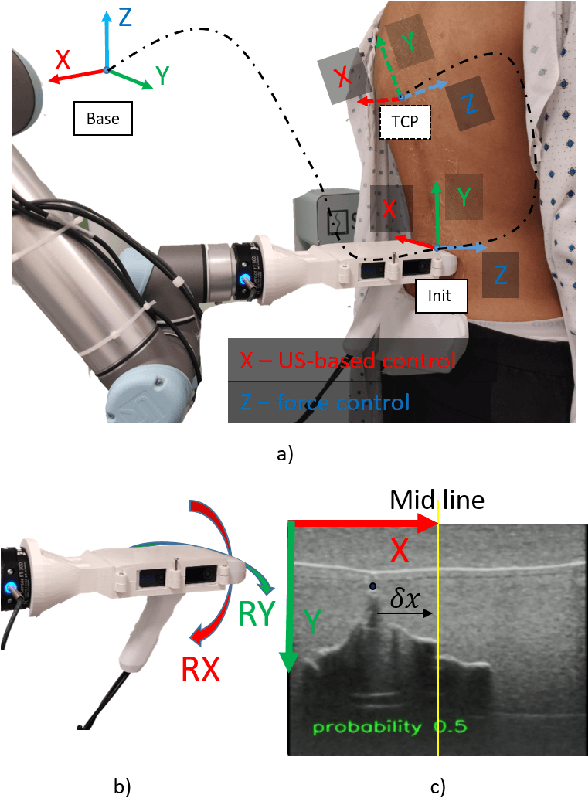 Figure 3 for Follow the Curve: Robotic-Ultrasound Navigation with Learning Based Localization of Spinous Processes for Scoliosis Assessment