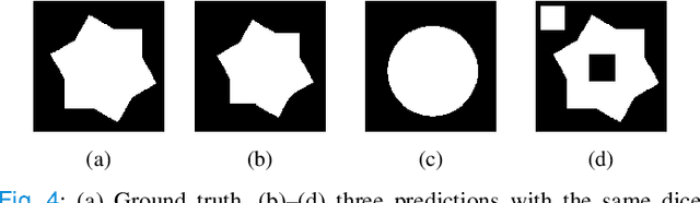 Figure 4 for FCSN: Global Context Aware Segmentation by Learning the Fourier Coefficients of Objects in Medical Images