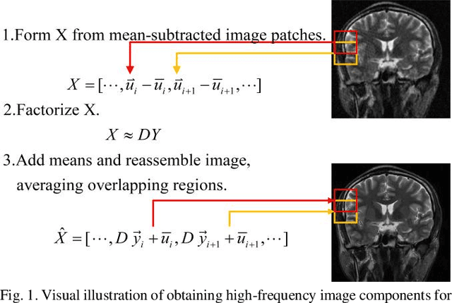 Figure 1 for Learning Priors in High-frequency Domain for Inverse Imaging Reconstruction