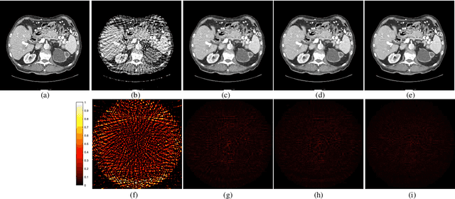 Figure 2 for Learning Priors in High-frequency Domain for Inverse Imaging Reconstruction