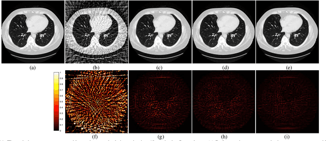 Figure 3 for Learning Priors in High-frequency Domain for Inverse Imaging Reconstruction