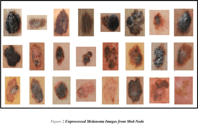 Figure 3 for Extended Feature Space-Based Automatic Melanoma Detection System
