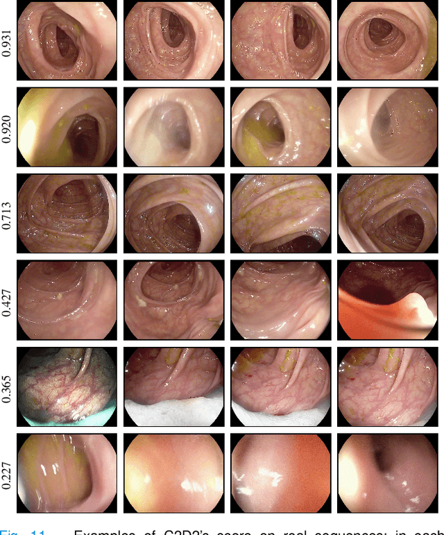 Figure 3 for Detecting Deficient Coverage in Colonoscopies
