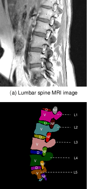 Figure 1 for Unifying Neural Learning and Symbolic Reasoning for Spinal Medical Report Generation