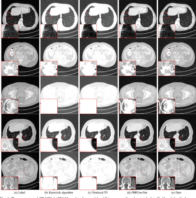 Figure 4 for A three-dimensional dual-domain deep network for high-pitch and sparse helical CT reconstruction