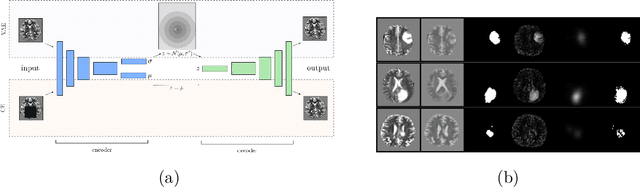 Figure 1 for Context-encoding Variational Autoencoder for Unsupervised Anomaly Detection