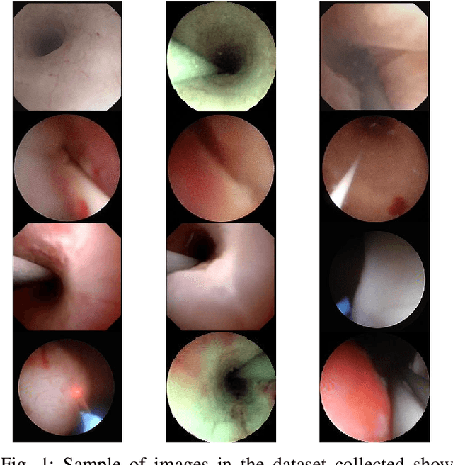 Figure 1 for A Lumen Segmentation Method in Ureteroscopy Images based on a Deep Residual U-Net architecture