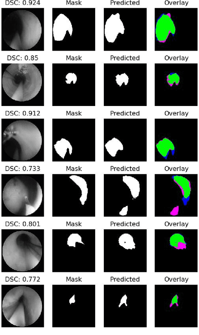 Figure 3 for A Lumen Segmentation Method in Ureteroscopy Images based on a Deep Residual U-Net architecture