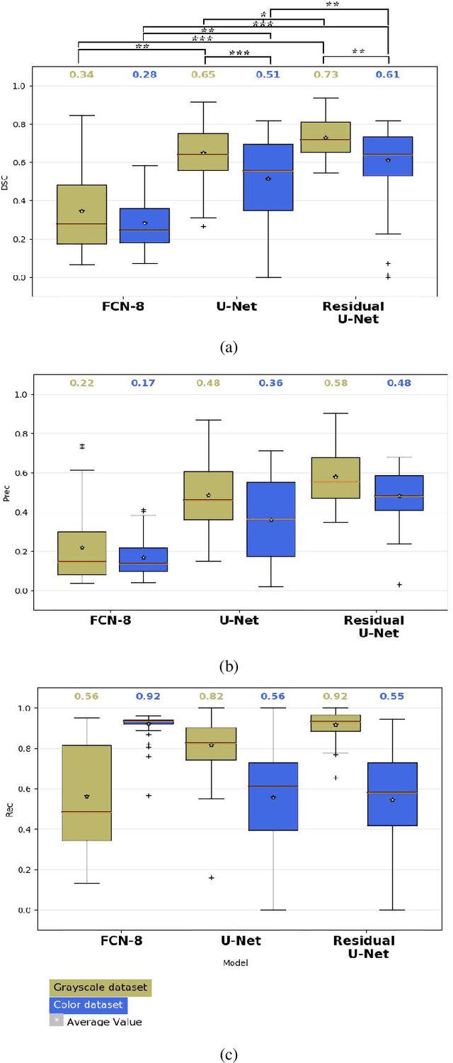 Figure 4 for A Lumen Segmentation Method in Ureteroscopy Images based on a Deep Residual U-Net architecture