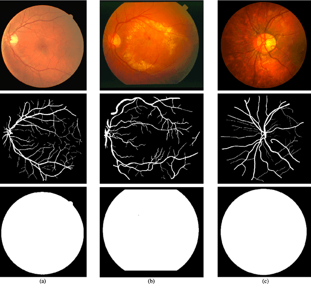 Figure 1 for Retinal Vessel Segmentation based on Fully Convolutional Networks