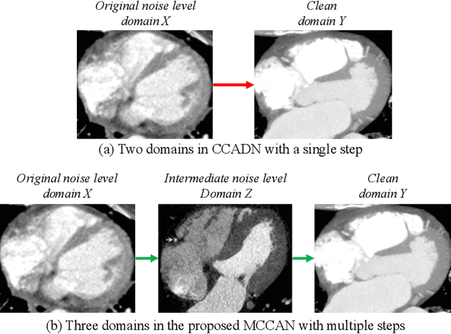 Figure 1 for Multi-Cycle-Consistent Adversarial Networks for Edge Denoising of Computed Tomography Images