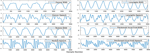 Figure 1 for Glottal Closure Instants Detection From Pathological Acoustic Speech Signal Using Deep Learning