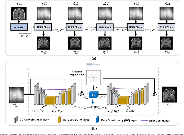 Figure 3 for A Long Short-term Memory Based Recurrent Neural Network for Interventional MRI Reconstruction