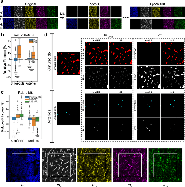 Figure 3 for Modality Attention and Sampling Enables Deep Learning with Heterogeneous Marker Combinations in Fluorescence Microscopy