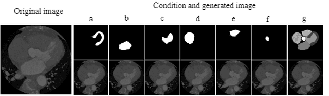 Figure 4 for Generation of Artificial CT Images using Patch-based Conditional Generative Adversarial Networks