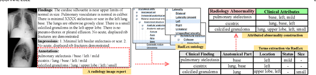 Figure 1 for Attributed Abnormality Graph Embedding for Clinically Accurate X-Ray Report Generation