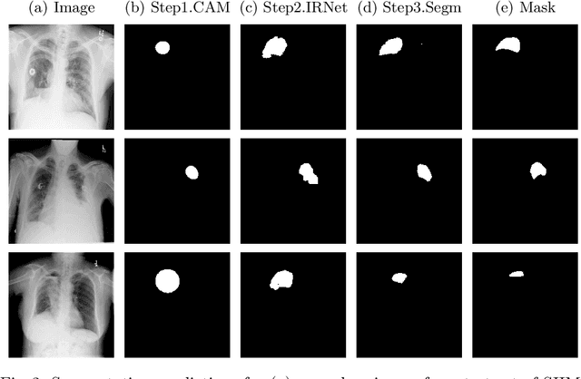 Figure 2 for Weakly-Supervised Segmentation for Disease Localization in Chest X-Ray Images