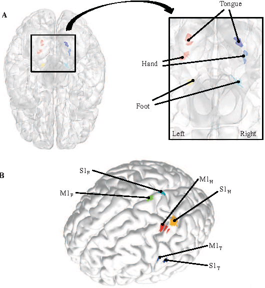 Figure 2 for Dictionary Learning and Sparse Coding-based Denoising for High-Resolution Task Functional Connectivity MRI Analysis