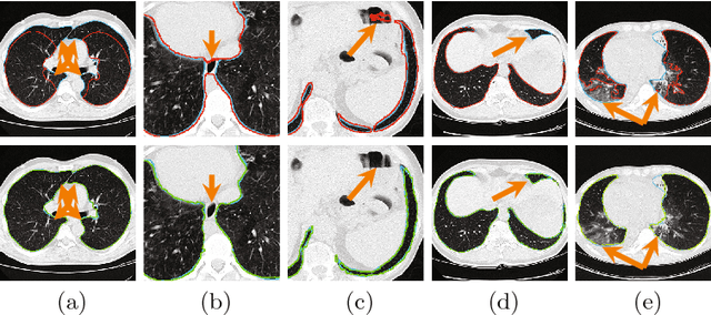 Figure 4 for Progressive and Multi-Path Holistically Nested Neural Networks for Pathological Lung Segmentation from CT Images