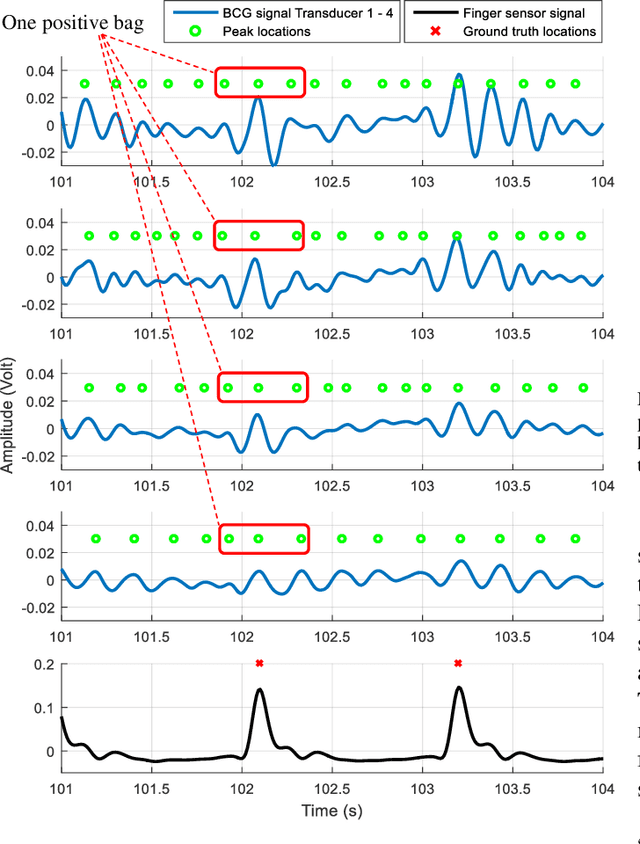 Figure 3 for Multiple Instance Dictionary Learning for Beat-to-Beat Heart Rate Monitoring from Ballistocardiograms