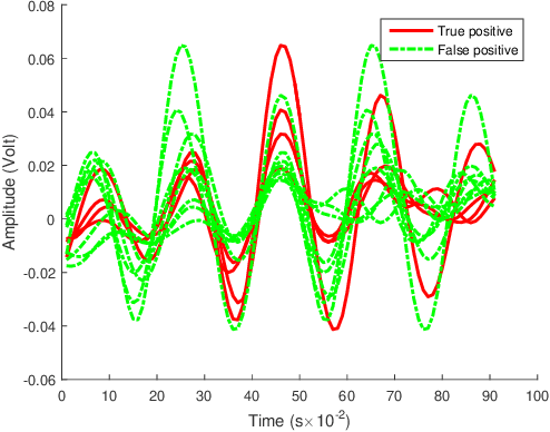 Figure 4 for Multiple Instance Dictionary Learning for Beat-to-Beat Heart Rate Monitoring from Ballistocardiograms