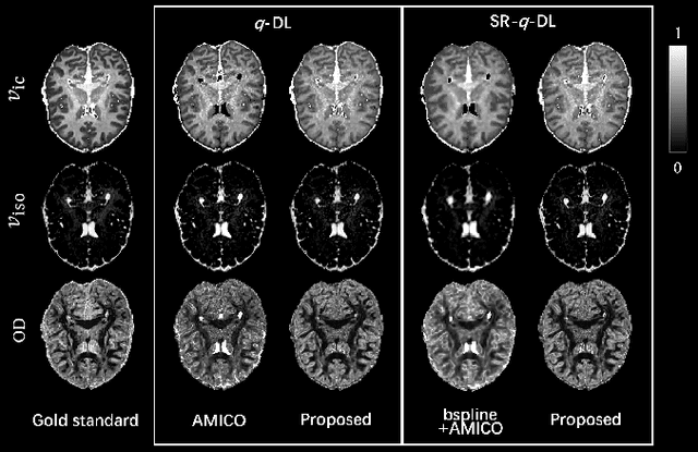 Figure 1 for Knowledge Transfer between Datasets for Learning-based Tissue Microstructure Estimation