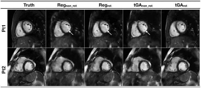 Figure 1 for Real-time Cardiovascular MR with Spatio-temporal Artifact Suppression using Deep Learning - Proof of Concept in Congenital Heart Disease