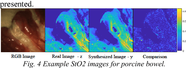 Figure 3 for Estimation of Tissue Oxygen Saturation from RGB Images based on Pixel-level Image Translation