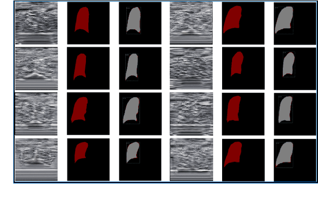 Figure 2 for DeepEDN: A Deep Learning-based Image Encryption and Decryption Network for Internet of Medical Things