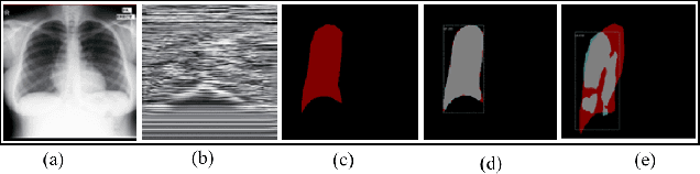 Figure 3 for DeepEDN: A Deep Learning-based Image Encryption and Decryption Network for Internet of Medical Things