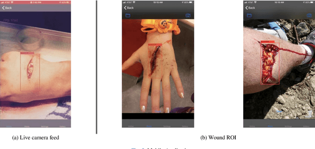 Figure 3 for A Mobile App for Wound Localization using Deep Learning