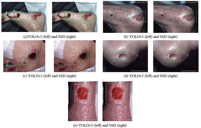 Figure 4 for A Mobile App for Wound Localization using Deep Learning