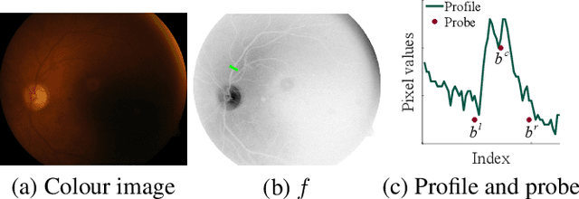 Figure 1 for Retinal vessel segmentation by probing adaptive to lighting variations