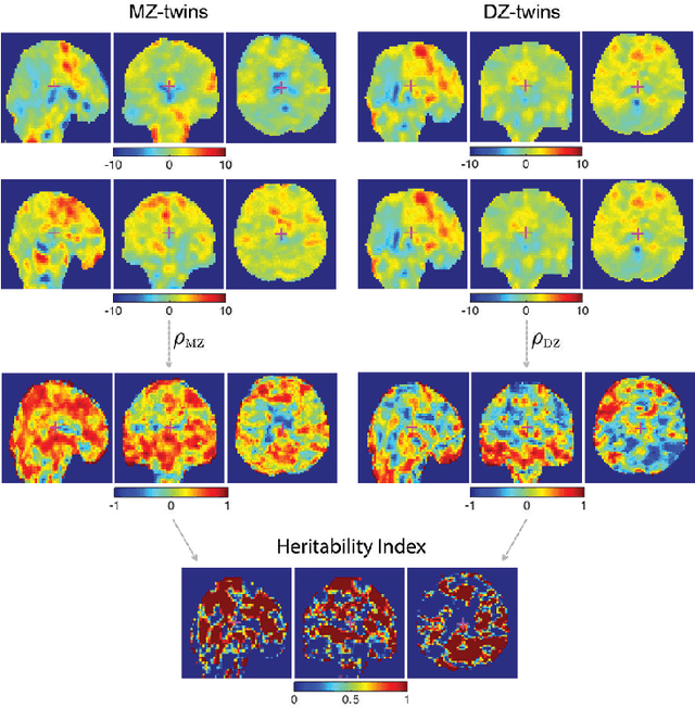 Figure 4 for Mapping Heritability of Large-Scale Brain Networks with a Billion Connections {\em via} Persistent Homology