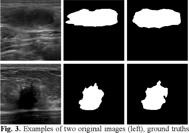 Figure 4 for EMT-NET: Efficient multitask network for computer-aided diagnosis of breast cancer