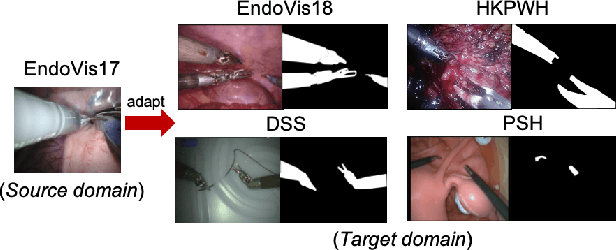 Figure 1 for One to Many: Adaptive Instrument Segmentation via Meta Learning and Dynamic Online Adaptation in Robotic Surgical Video