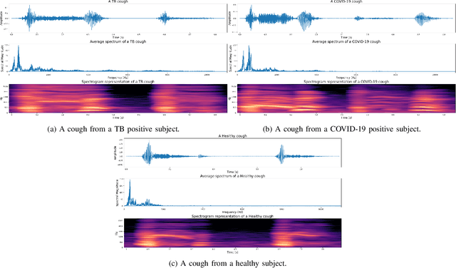Figure 1 for Automatic Tuberculosis and COVID-19 cough classification using deep learning