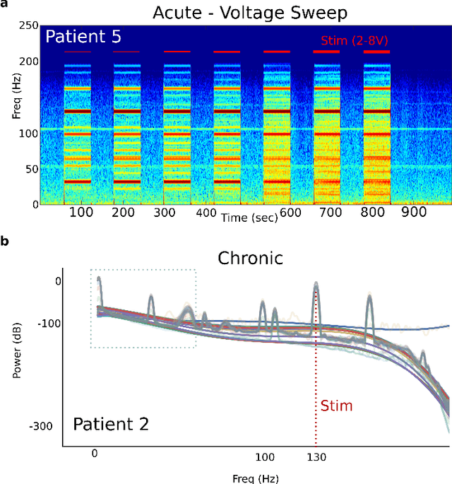 Figure 3 for Mitigating Mismatch Compression in Differential Local Field Potentials