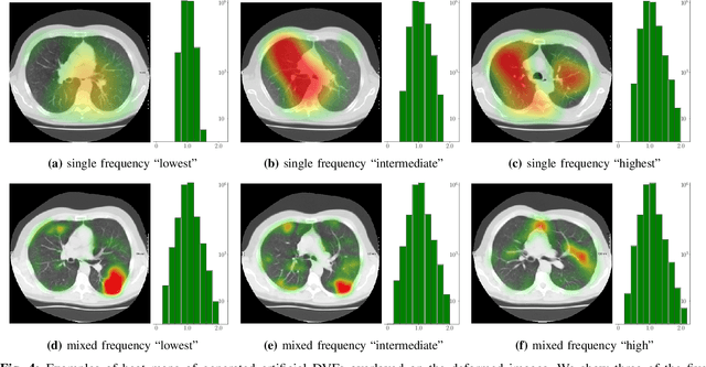 Figure 4 for 3D Convolutional Neural Networks Image Registration Based on Efficient Supervised Learning from Artificial Deformations