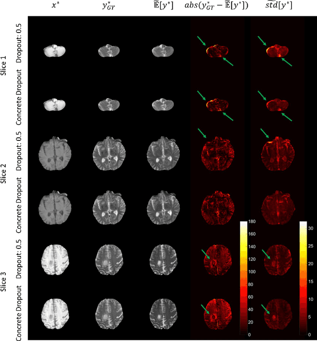 Figure 3 for Bayesian Conditional GAN for MRI Brain Image Synthesis