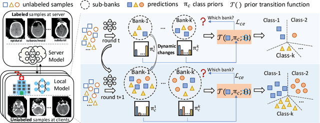 Figure 1 for Dynamic Bank Learning for Semi-supervised Federated Image Diagnosis with Class Imbalance